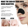 10 Pcs Blackhead Nose Patches pack