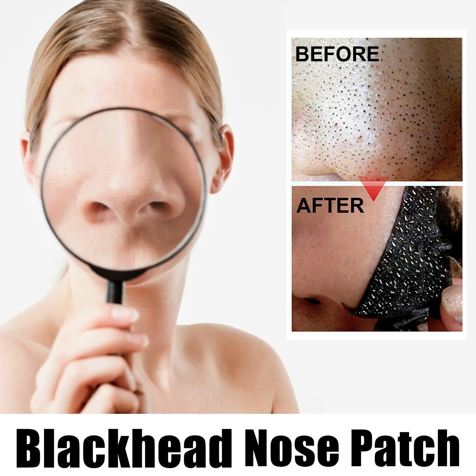 Close-up of blackhead nose patch texture