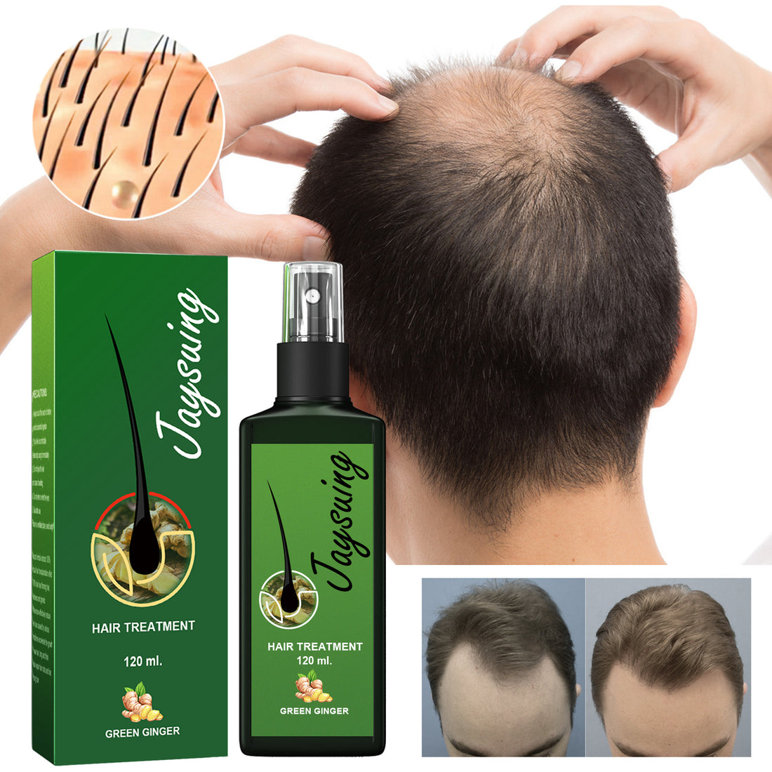 Jaysuing Ginger Hair Treatment Spray bottle