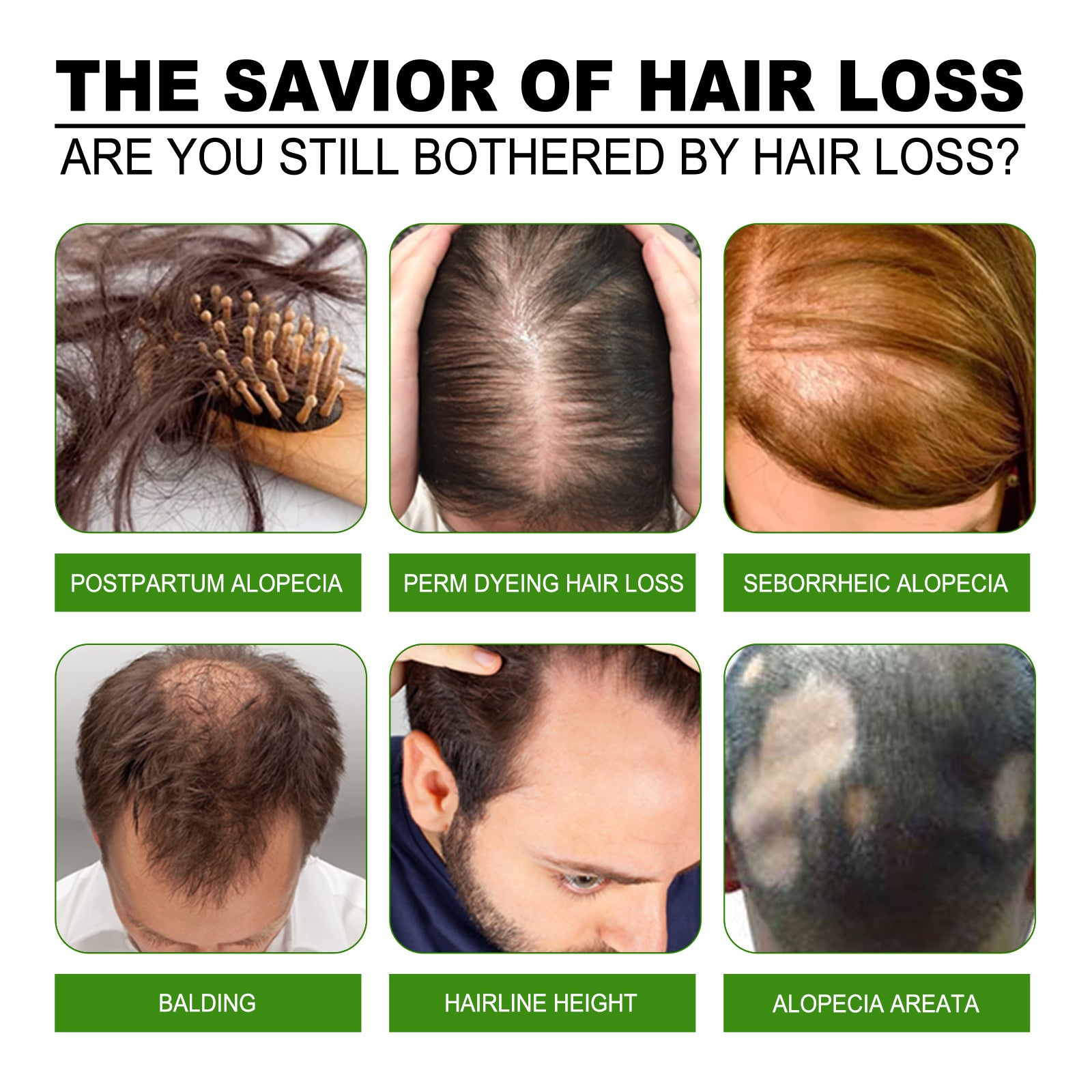 Application of Jaysuing Ginger Hair Treatment to scalp

